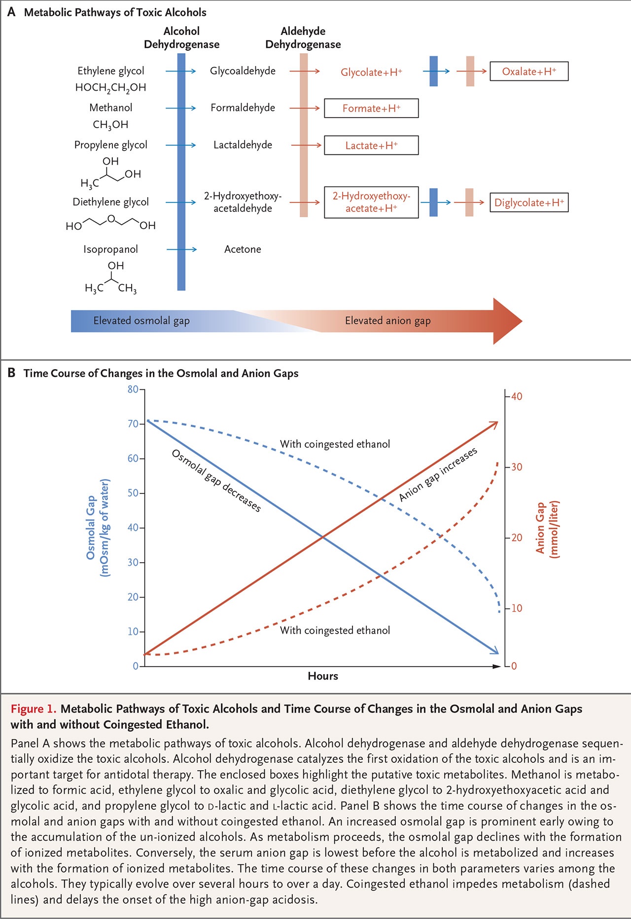 Toxic Alcohol Ingestion NEJM Resident 360